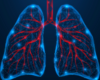 Surgical Advancements in Lung Transplant