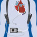 Illustration of a LVAD