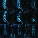Scan of human spine