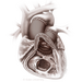 Illustration of Domino Partial Heart Transplant