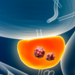 Prostate cancer with organs and tumor or cancerous cells 3D rendering illustration