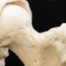 Doctor presenting hip-joint.