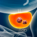 Prostate cancer with organs and tumor or cancerous cells 3D rendering illustration