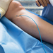 Doctors doing vein surgery procedure