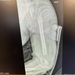Radiograph of elbow graft