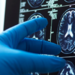 A doctor's hand in a surgical glove pointing at a brain scan image on a computer screen