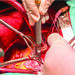 Mitral Valve Repair