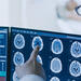 Doctors reviewing brain radiographs