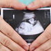 Fetal imaging picture