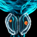 Illustration of prostate cancer