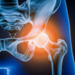 Illustration of hip joing