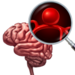 Illustration of brain and closeup of an unruptured aneurysm