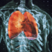 3d xray of lungs