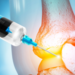Anatomy Human Knee Joint Treatment, Osteoarthritis Injection