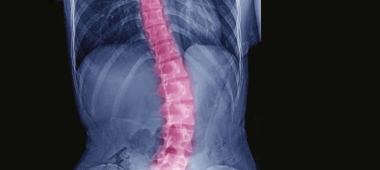 spine xray