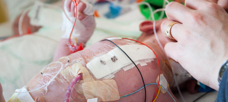 Infant in ICU